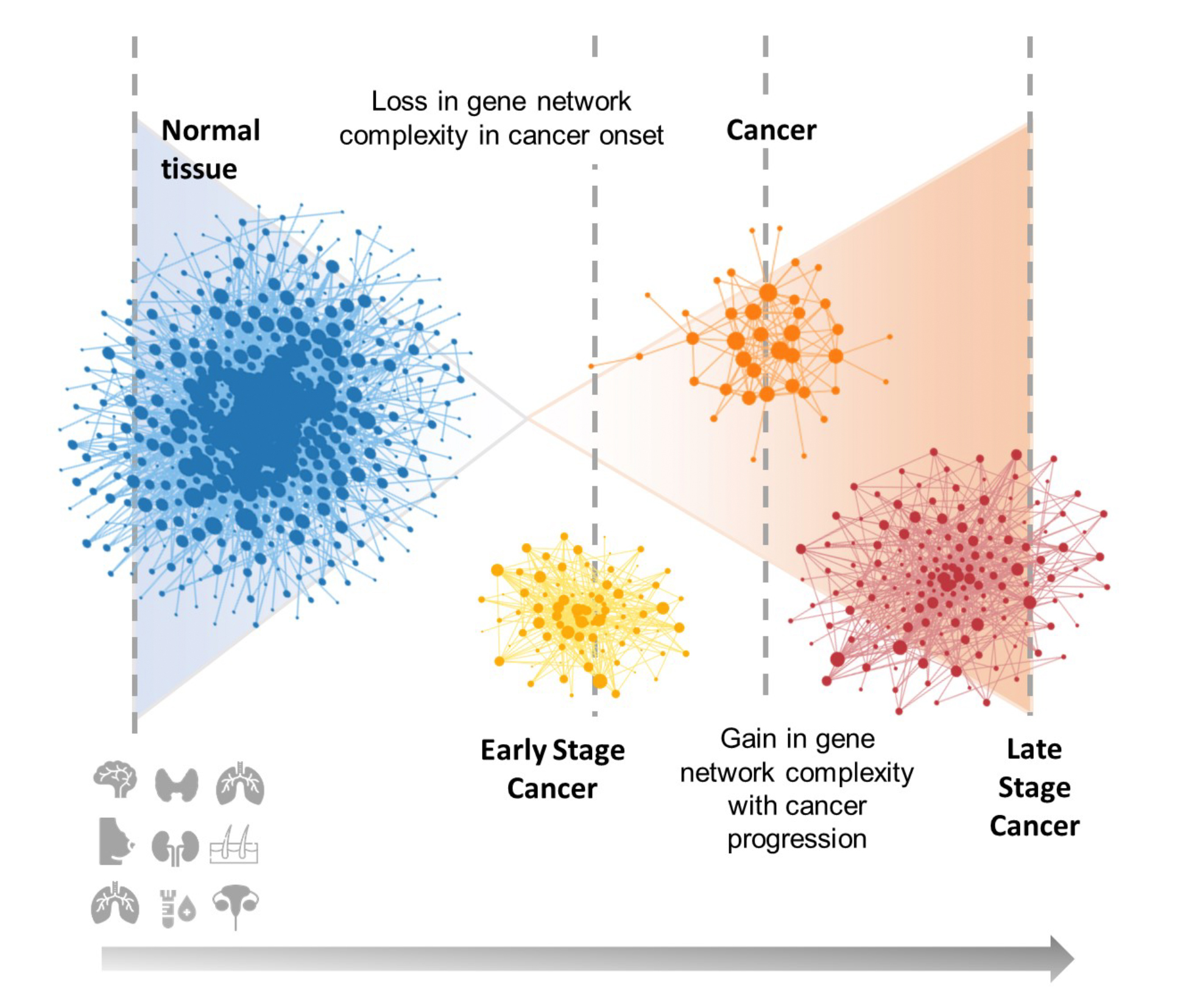 A graphic showing network complexity during various stages of cancer. (Graphic courtesy Zainab Arshad)