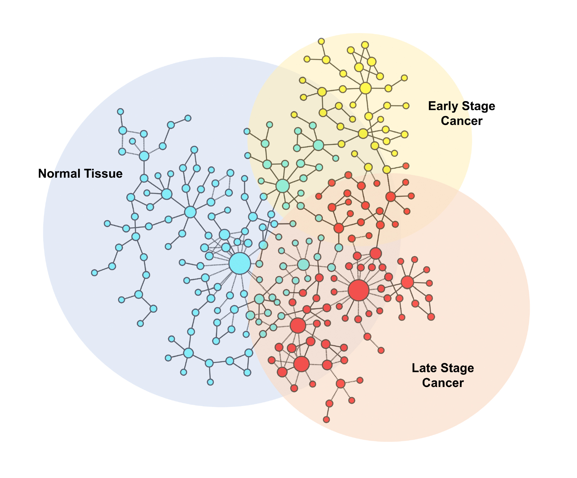 Network connections during various stages of cancer. (Graphic courtesy Zainab Arshad) 