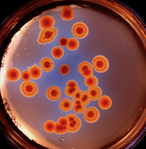 Biofilms of P. aeruginosa 