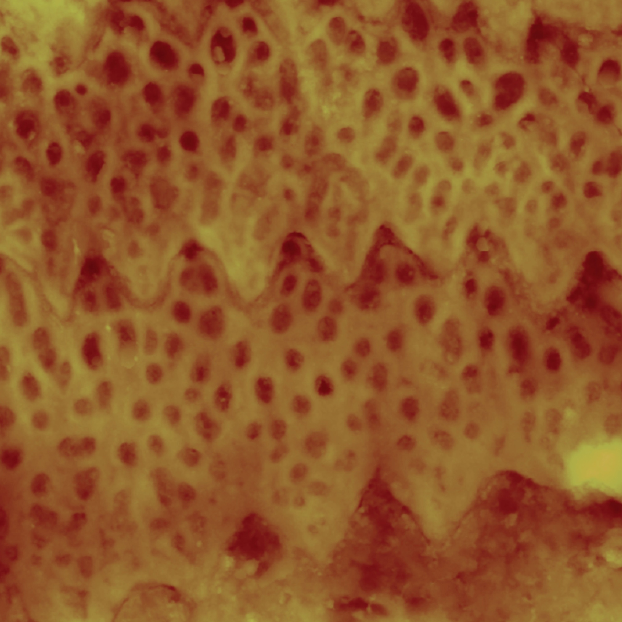 Sidewinder snake microstructures