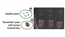 Healthy vs damaged yeast (Courtesy of Yury Chernoff) Healthy vs damaged yeast (Courtesy of Yury Chernoff)