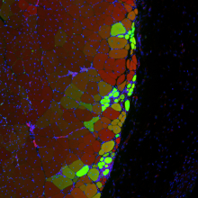 New muscle strands thanks to stem cell hydrogel New muscle strands thanks to stem cell hydrogel