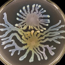Pseudomonas aeruginosa (Photo by Steve Diggle/Georgia Tech) Pseudomonas aeruginosa (Photo by Steve Diggle/Georgia Tech)