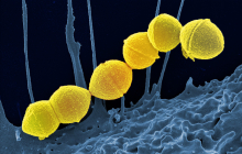 Group A Streptococci NIAID Group A Streptococci NIAID