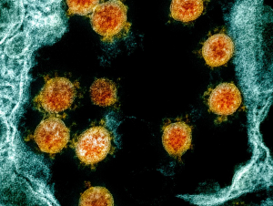 This colorized transmission electron micrograph shows SARS-CoV-2 virus particles (orange), isolated from a patient. Credit: NIAID via NIH