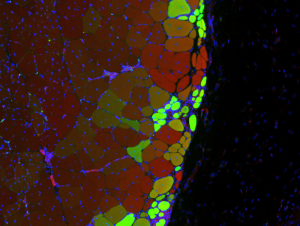 New muscle strands thanks to stem cell hydrogel