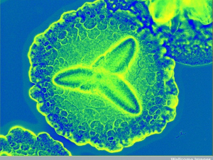 Periodontitis culprit Aggregatibacter actinomycetemcomitans by CC