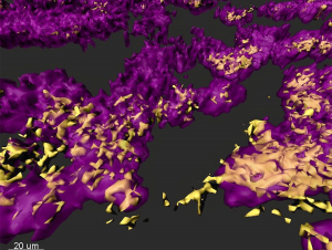 Bacterial biofilm