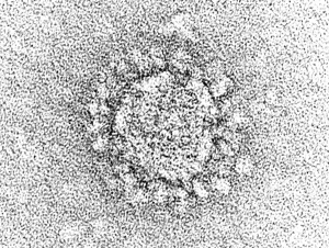 Electron microscope image of coronavirus particle