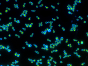 Green rhodopsin proteins inside the blue cell walls help these yeast grow faster when exposed to light. Photo: Anthony Burnetti, Georgia Institute of Technology.