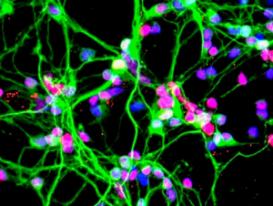 Neurons growing in a culture dish (NASA)