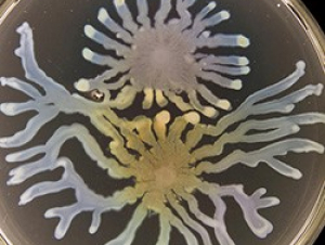 Pseudomonas aeruginosa (Photo by Steve Diggle/Georgia Tech)