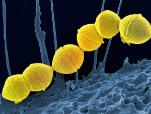 Group A Streptococci NIAID