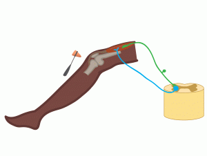 Tendon Tap