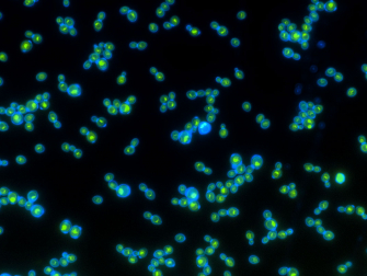 Green rhodopsin proteins inside the blue cell walls help these yeast grow faster when exposed to light. Photo: Anthony Burnetti, Georgia Institute of Technology.