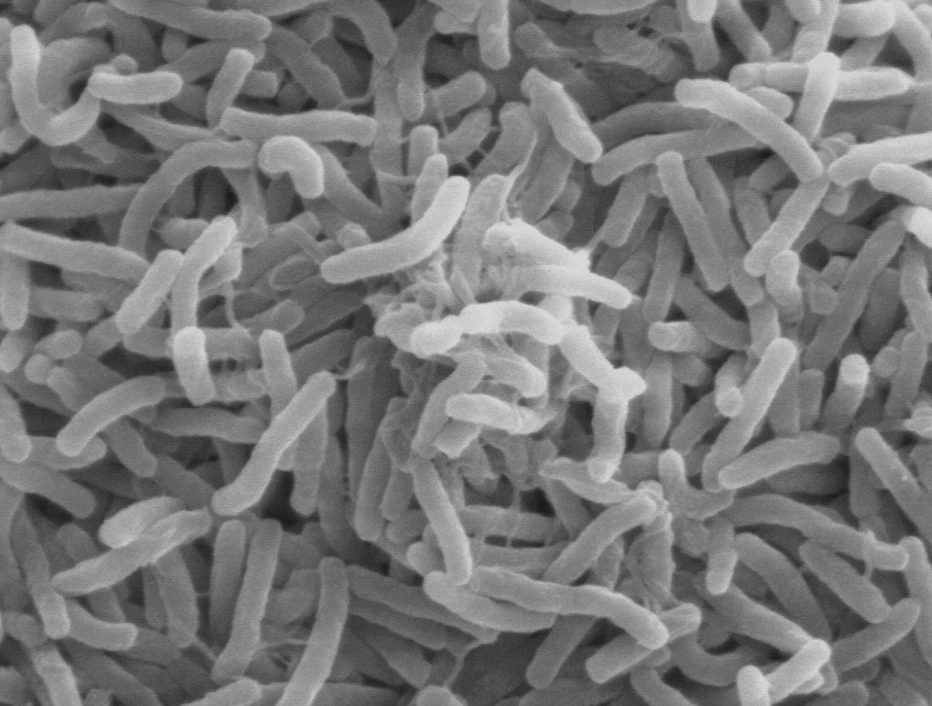 Vibrio cholerae bacteria (Photo Wikimedia Commons)